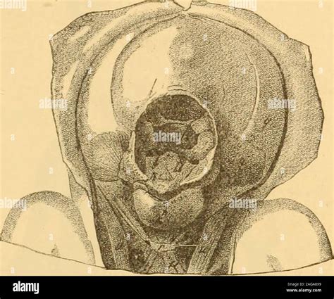 Cyclopia Hi Res Stock Photography And Images Alamy