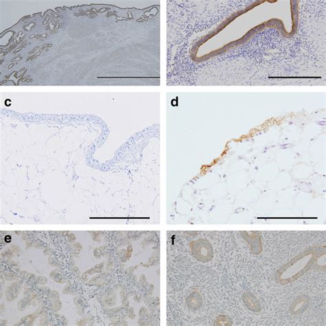 Immunohistochemistry Of Paraffin Tissue Sections Using Mouse Monoclonal