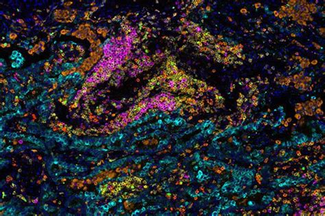 Opal Multiplex IHC Kits TSA Reagents And Assays Akoya Biosciences