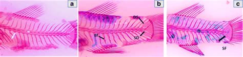 Micrographs Of Vertebral Deformities Observed In Aphanius Fasciatus A