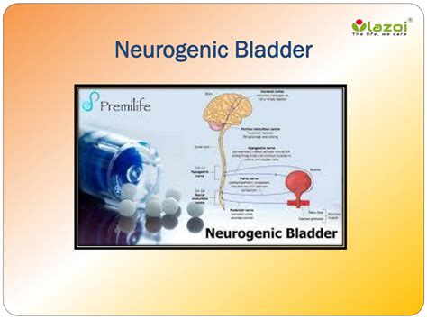 Ppt Neurogenic Bladder Causes Symptoms Daignosis Prevention And