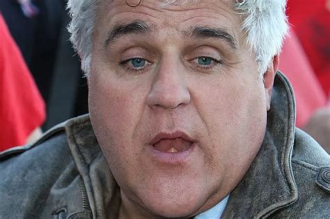 Jay Leno Tells Story Of How His Face Caught On Fire During Car Garage