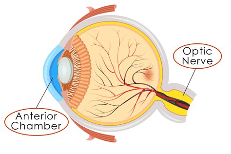 glaucoma_eye-diagram_optic-nerve - Eye Care Specialists Ophthalmology Services