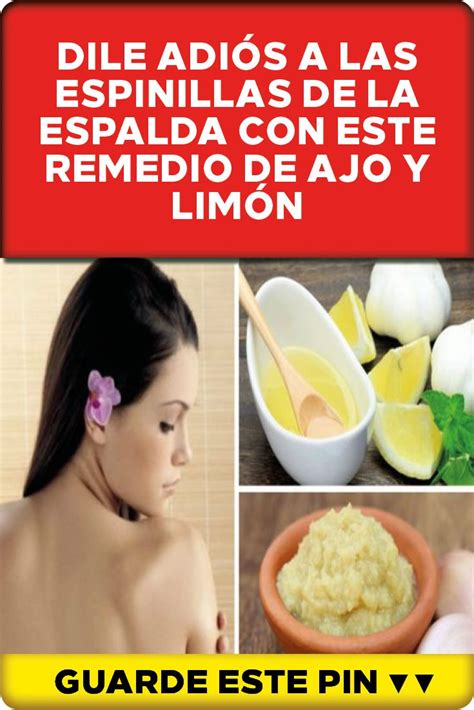 Dile adiós a las espinillas de la espalda con este remedio de ajo y