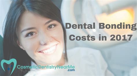 Dental Bonding Costs In 2017 YouTube