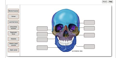 Solved Mental Foramen Vomer Lacrimal Bone Infraorbital Foramen