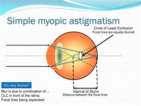 PPT - Subjective refraction PowerPoint Presentation, free download - ID:437072