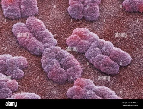 Human Chromosomes Coloured Scanning Electron Micrograph Sem Of Human Chromosomes Each