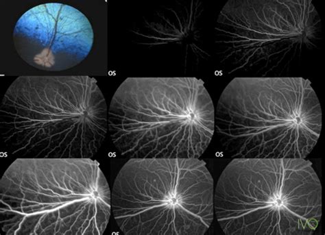 Angiografía fluoresceínicia qué es y cómo se realiza en animales IVO