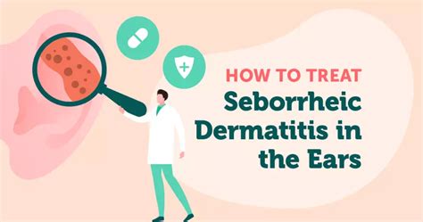 How To Treat Seborrheic Dermatitis In The Ears Mysebdermteam