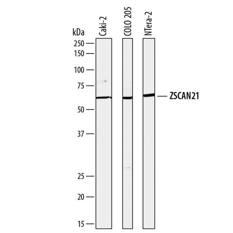 Human ZSCAN21 Antibody R D Systems 100μg Unlabeled Fisher Scientific