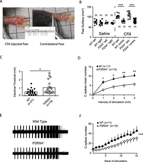 P2X4 Is Involved In Complete Freund Adjuvant CFA Induced