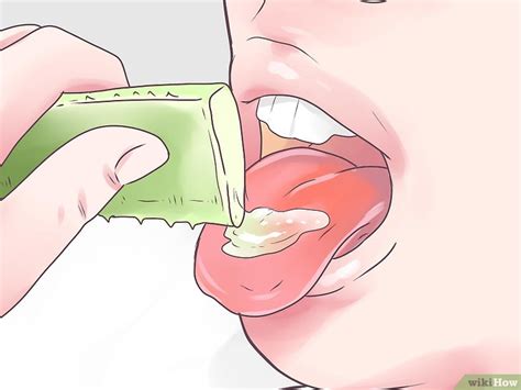 How To Treat Burning Tongue