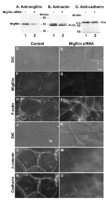 Depletion Of Migfilin Compromises The Organization Of Adherens