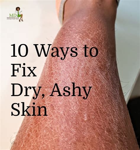 10 Ways To Fix Dry Ashy Skin Dry Skin Legs Dry Flaky Legs Dry