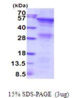 Recombinant Human Angiopoietin Like Protein Angptl His Protein Nbp