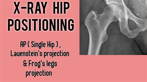 X Ray Hip Joint Ap Lateral Hip X Ray Positioning Hip X Ray Kaise Hota Hai X Ray Hip Joint