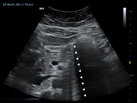 Ultrasound Physics And Technical Facts For The Beginner Sonoguide