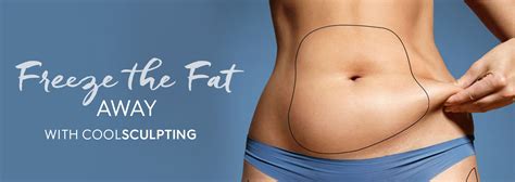 Coolsculpting Fat Reduction London Beyond Medispa