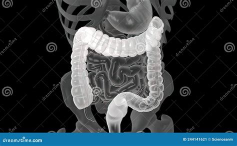 Colonoscopy Biopsy Of The Gastrointestinal Tract In Patients Stock