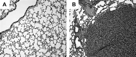 Tumorigenesis In B6c3f1 Mice Exposed To Ozone In Combination With 4 N Methyl N Nitrosamino 1