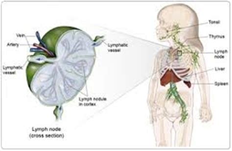 Childhood Lymphoma - Assignment Point