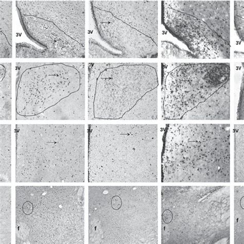 Representative Photomicrographs Showing C Fos Immunoreactive F Ir