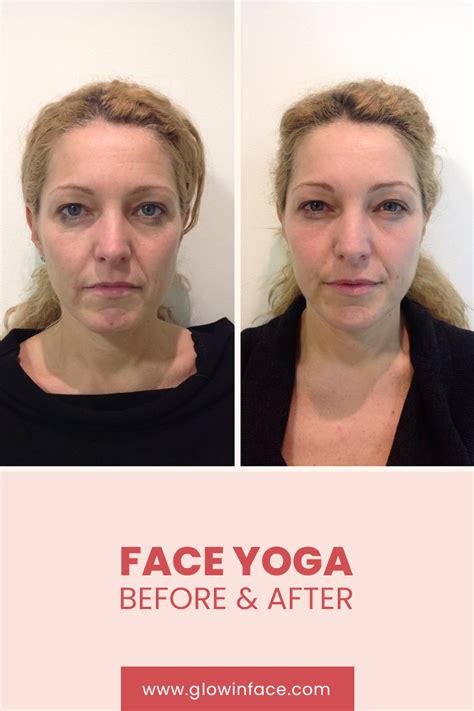 Pin On Face Yoga Before And After