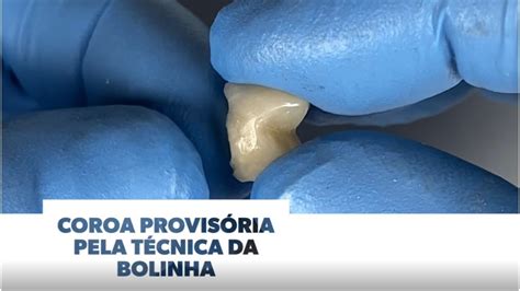 Coroa provisória posterior pela técnica da bolinha YouTube