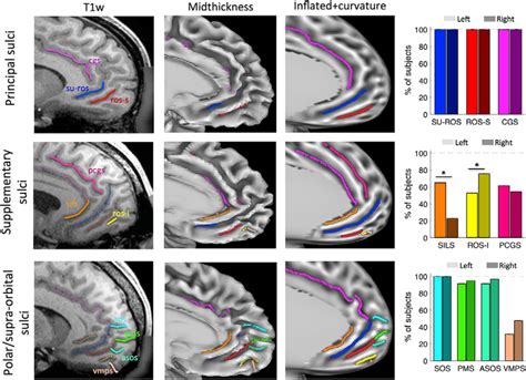 Ventrolateral Prefrontal Cortex