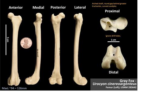 Bones Osteoid Bone Identification