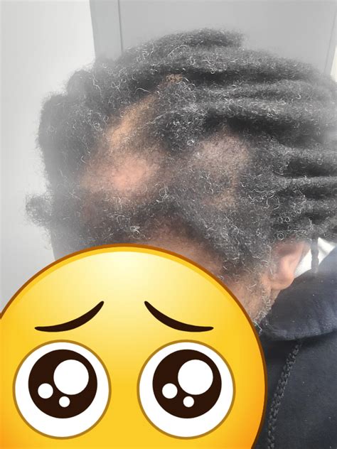 New products will soon support Twist and dreadlocks health 22