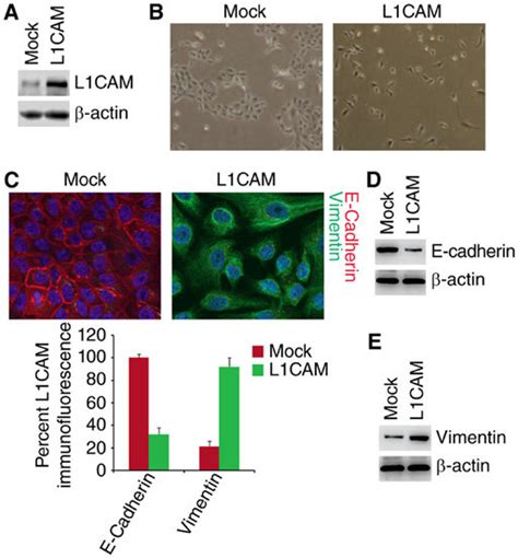 L Cam Promotes Emt In Endometrial Cancer Hec A Cells A Western Blot