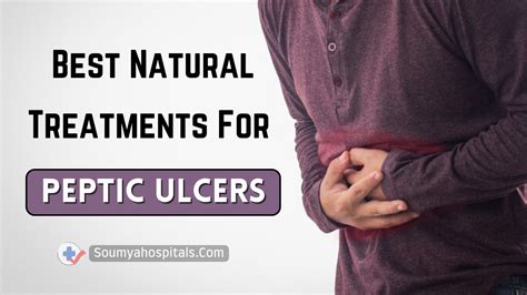 Best Natural Treatments For Peptic Ulcers Soumyahospitals