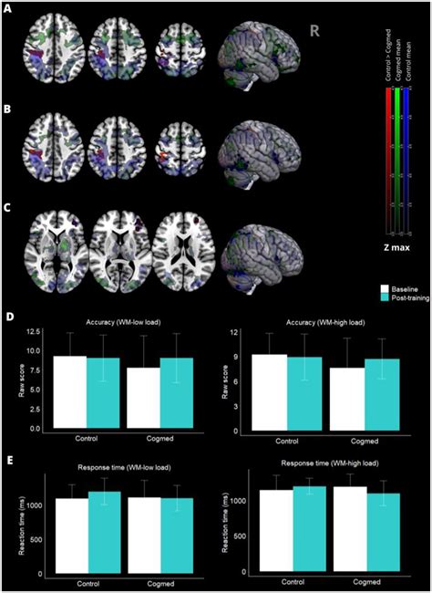 Frontiers Computerized Working Memory Training For Hypertensive