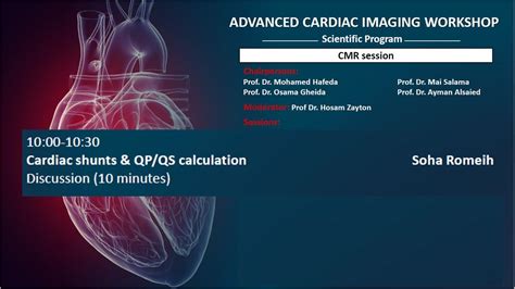 Cardiac Shunts And How To Measure QP QS Live Recording YouTube