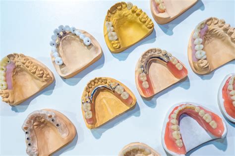 Different Types Of Dentures And Their Uses And Benefits