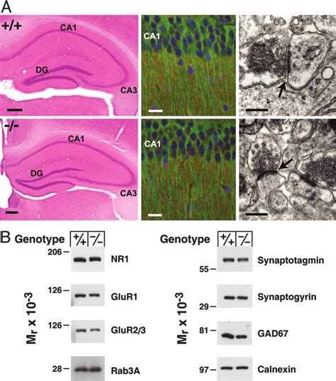 Histology And Protein Expression In The Hippocampus A Left