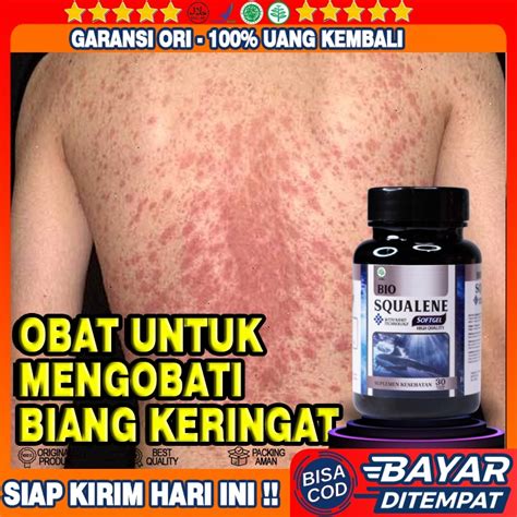 Jual Obat Biang Keringat Obat Biang Keringat Di Leher Obat Biang