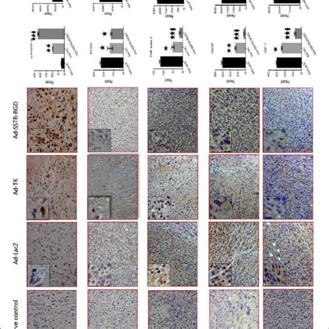 Immunohistochemical Staining Hematoxylin Eosin Stain Of Leiomyoma