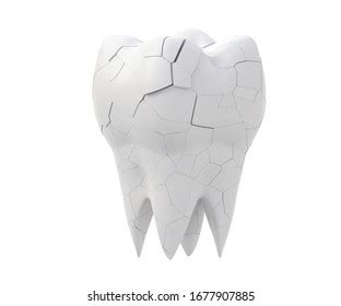 D Dentist Crack Images Stock Photos D Objects Vectors