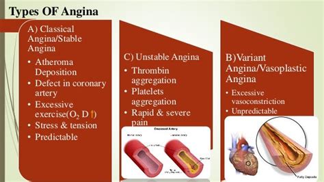 Angina Pectroris