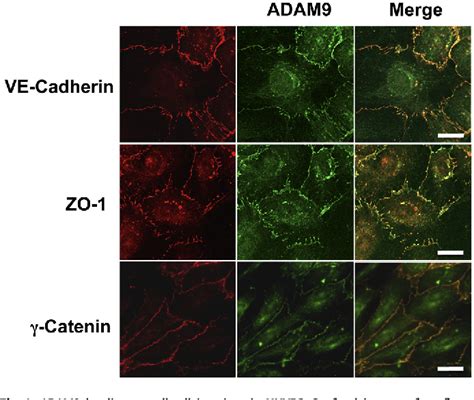 PDF ADAM9 Is Present At Endothelial Cell Cell Junctions And