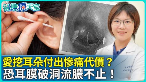 【健康療天室】耳膜破洞流膿不止怎麼辦？ 愛挖耳朵恐付出慘痛代價！chinatimes Youtube