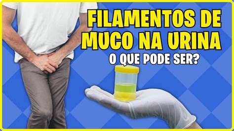 Filamentos De Muco Na Urina O Que Significa Youtube