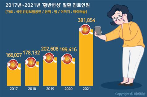 대표적 노인성 안질환 ‘황반변성 환자 지난 해 급증