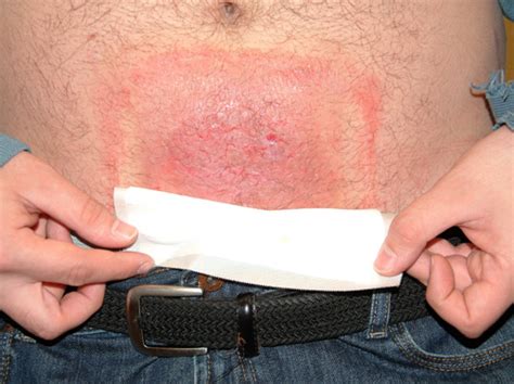 A persistent rash eludes treatment | Clinician Reviews