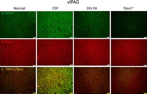 Immunofluorescence Staining Of TRPV1 Iba1 And Double Staining Protein