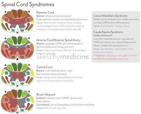 Oren Gottfried Md On Twitter Spinal Cord Syndromes From Sketchy