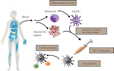 Frontiers Dendritic Cell Vaccine Of Gliomas Challenges From Bench To Bed